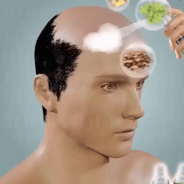 Spray-ul VitalHair™